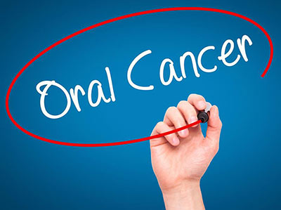 Oral cancer visual