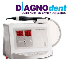 diagno dent laser