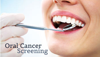 Oral Cancer Screening