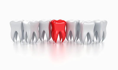Why is a root canal better than an extraction?